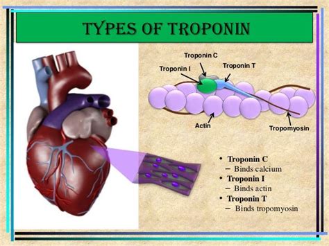 Troponin Definition & Meaning .